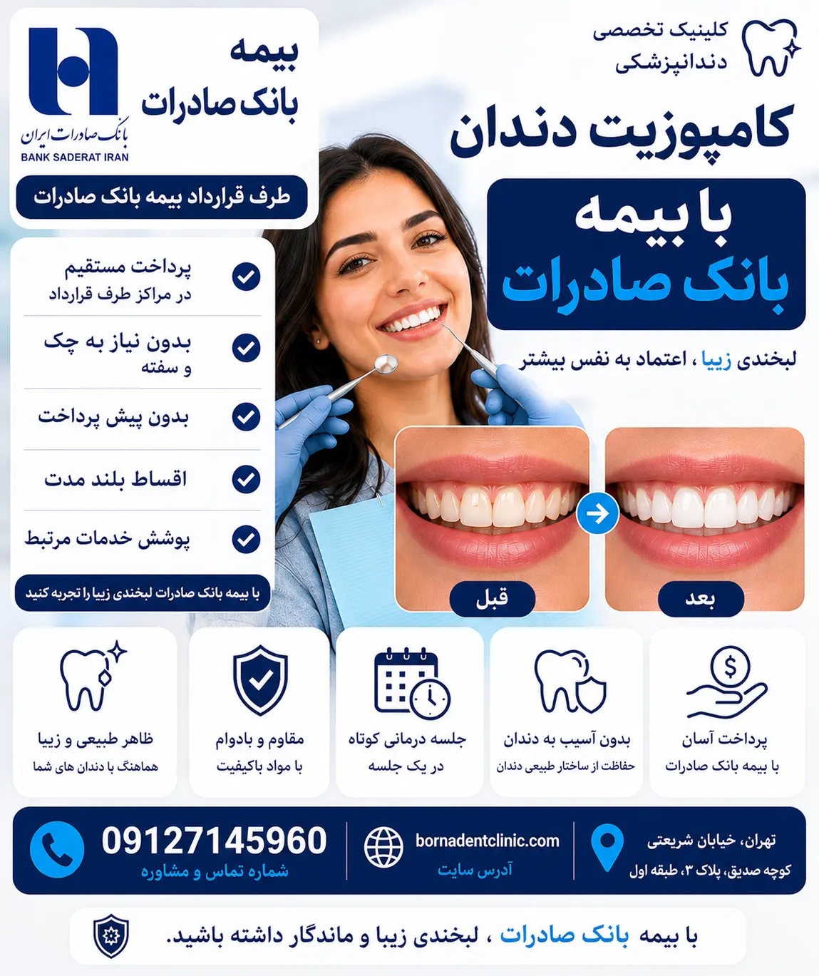 کامپوزیت دندان با بیمه بانک صادرات