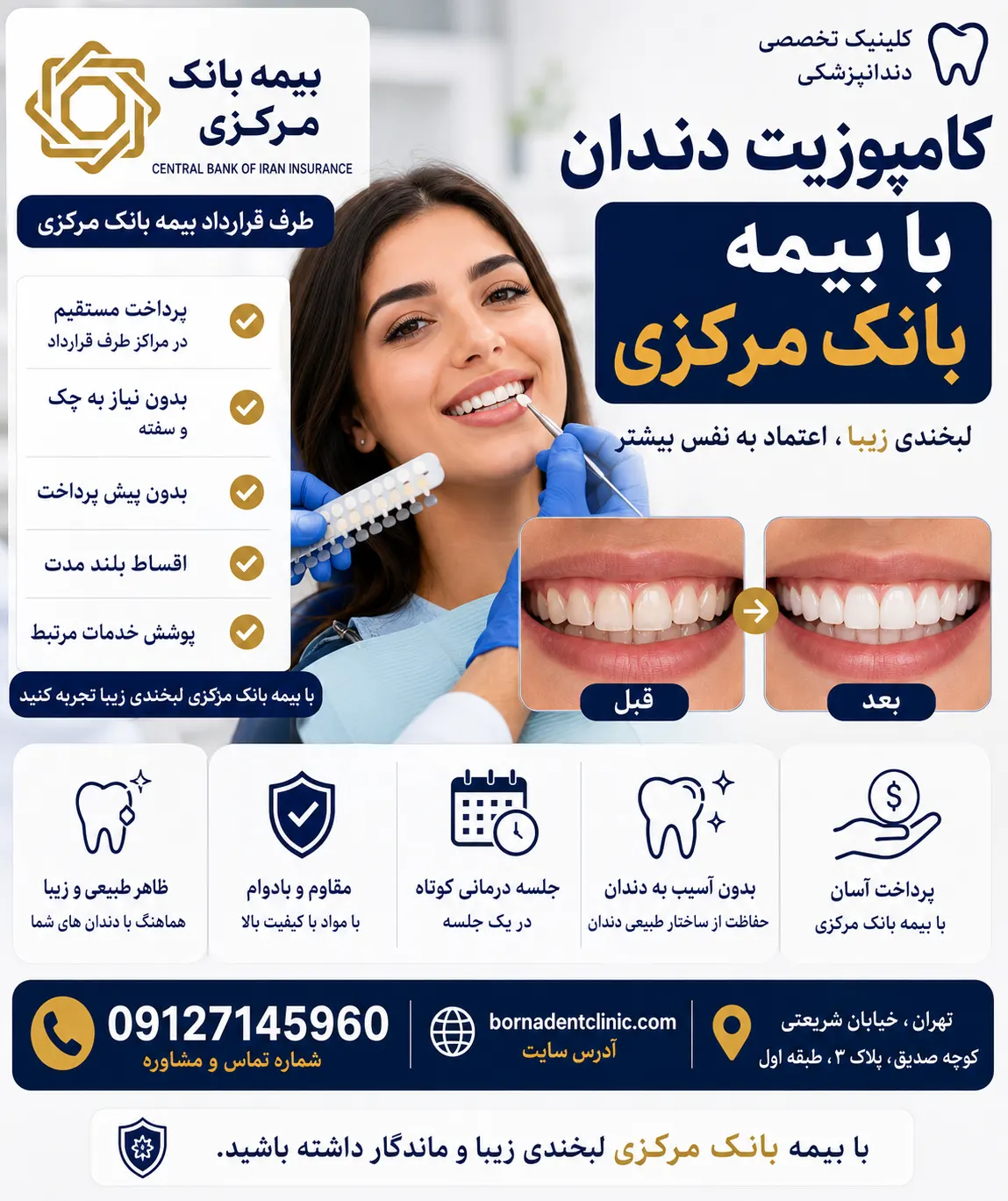 کامپوزیت دندان با بیمه بانک مرکزی