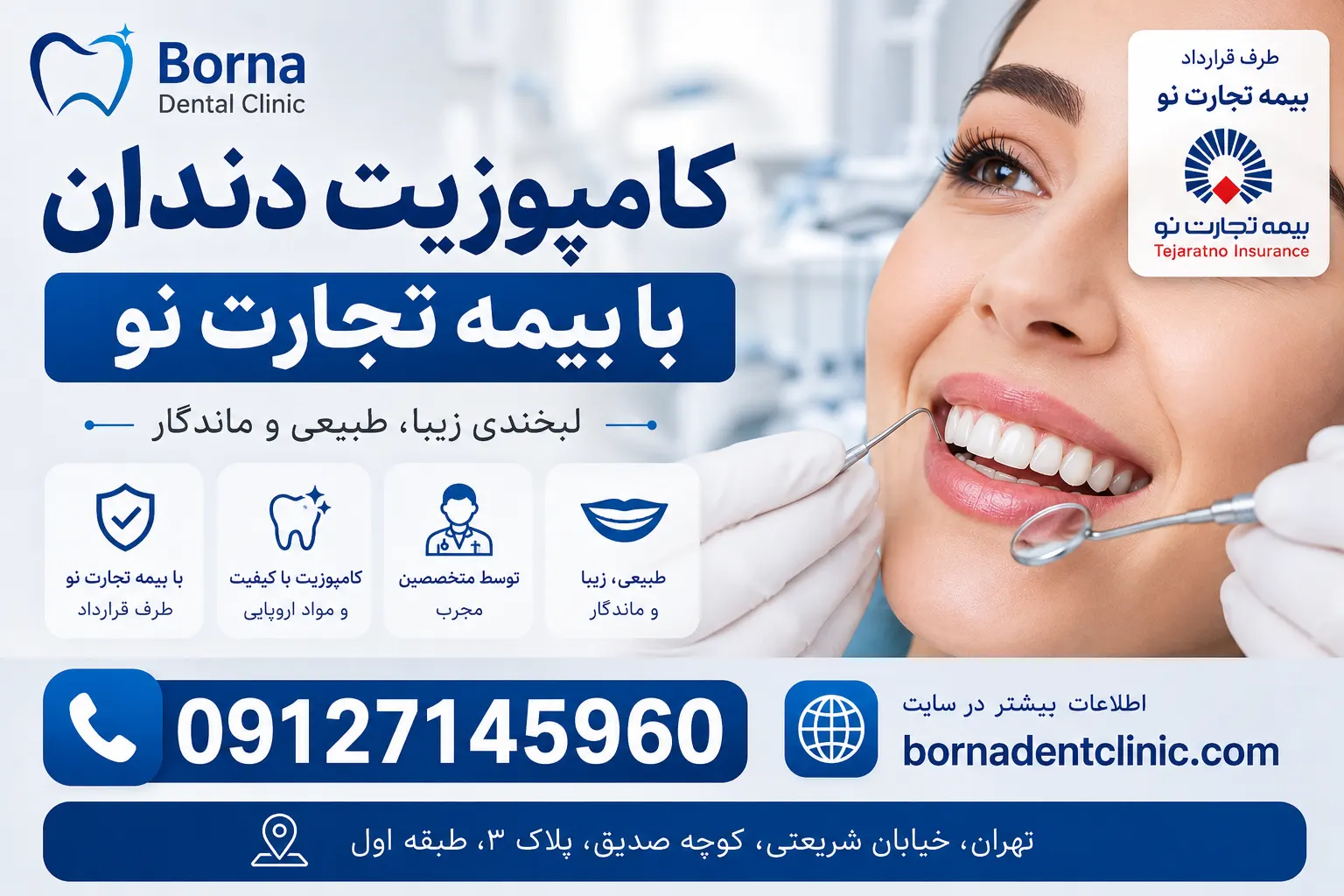 کامپوزیت دندان با بیمه تجارت نو