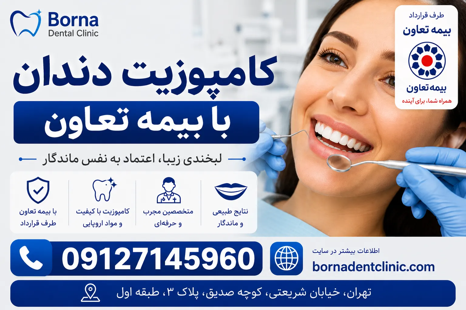 کامپوزیت دندان با بیمه تعاون