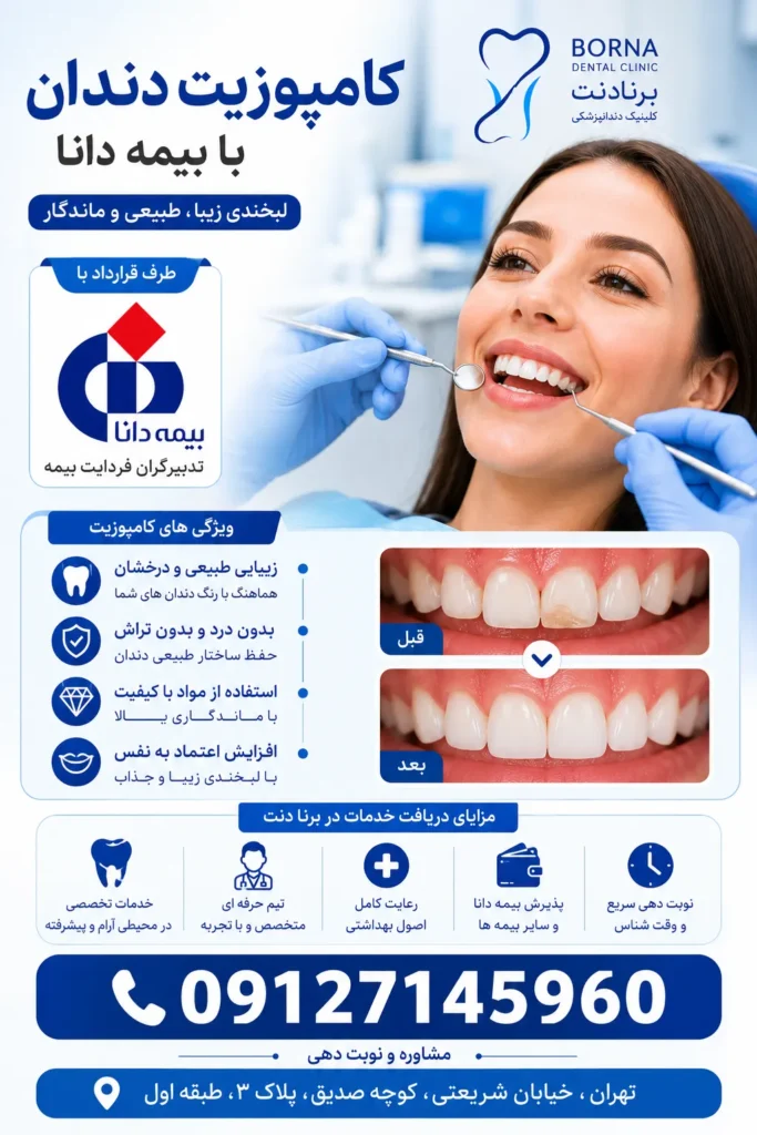 کامپوزیت دندان با بیمه دانا