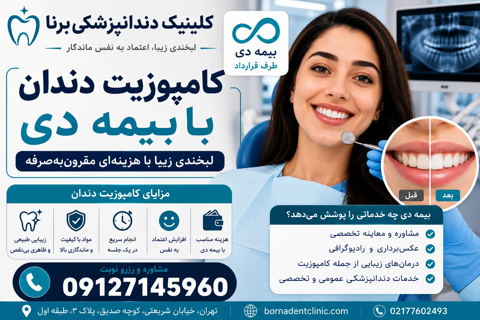 کامپوزیت دندان با بیمه دی