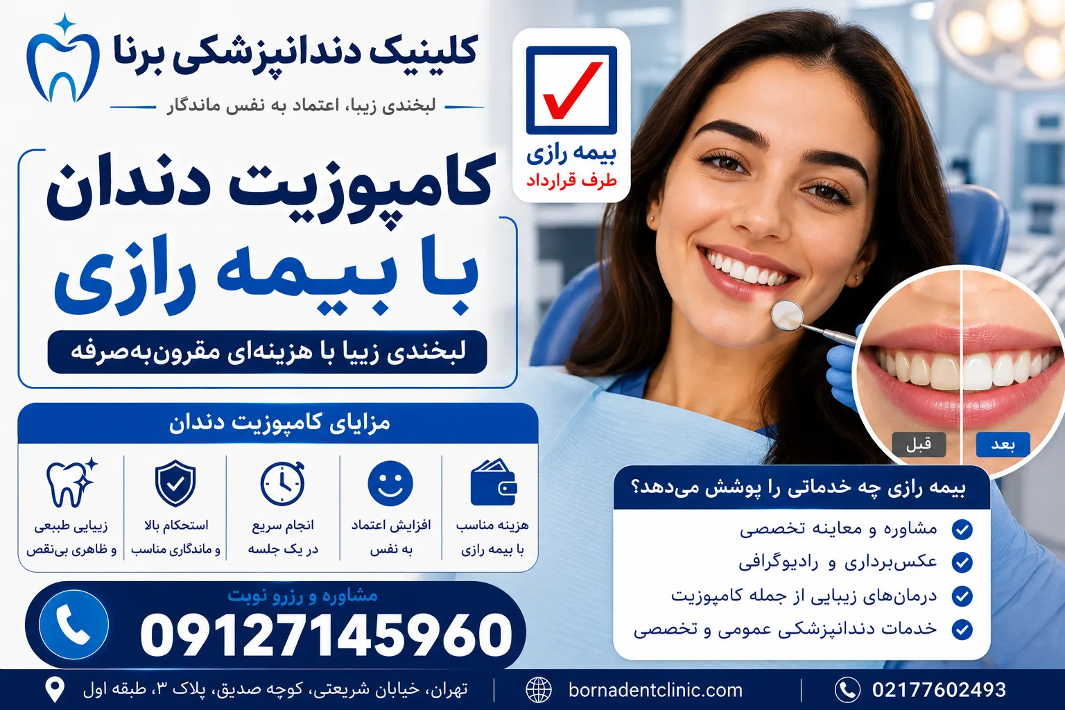 کامپوزیت دندان با بیمه رازی