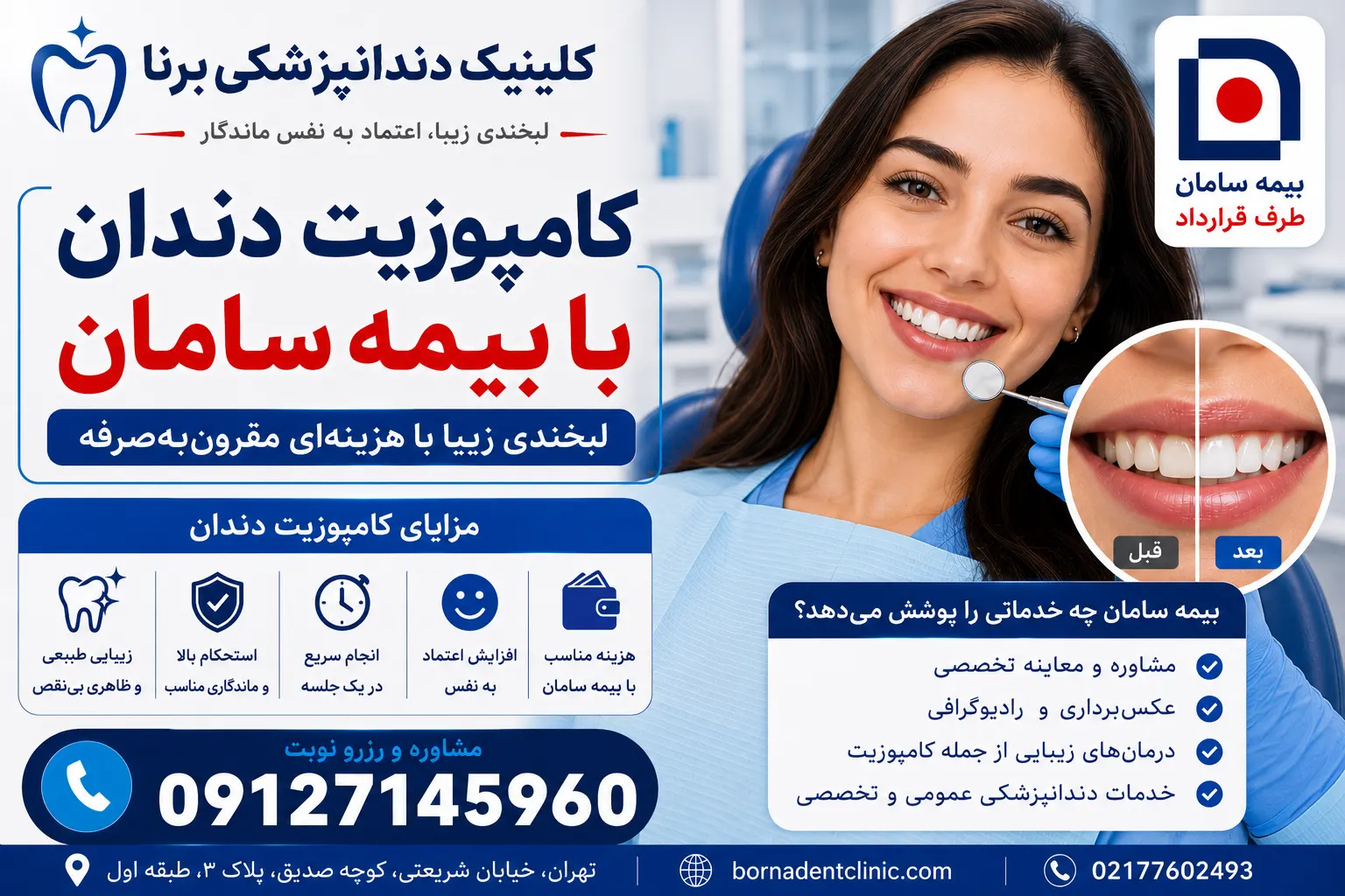 کامپوزیت دندان با بیمه سامان