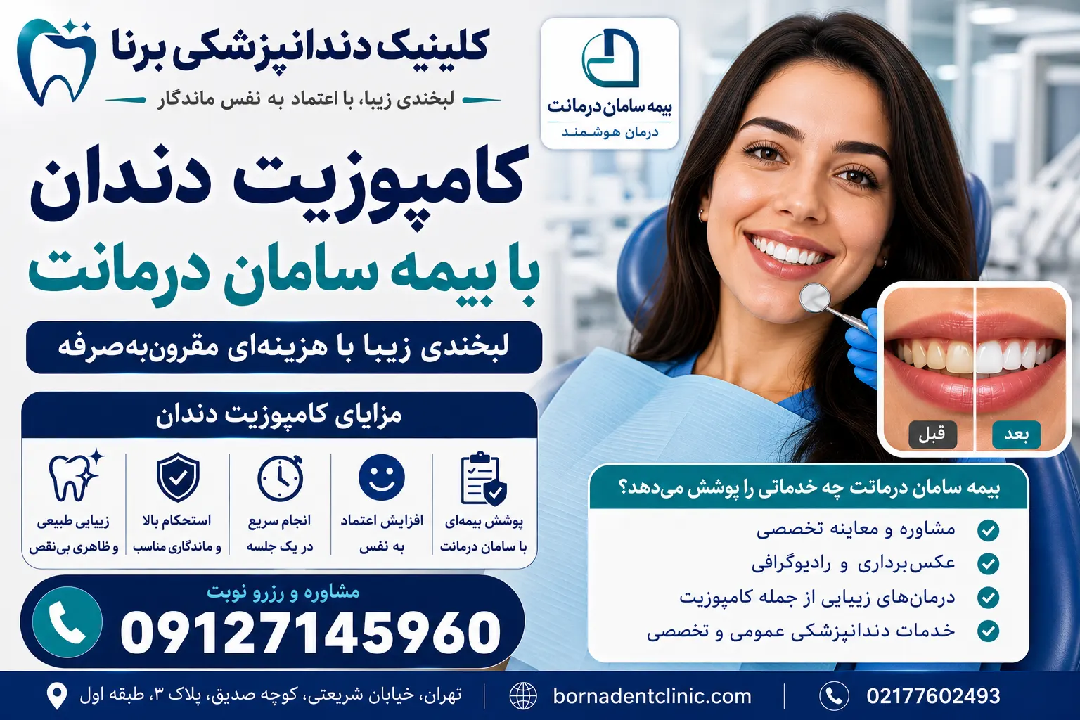 کامپوزیت دندان با بیمه سامان درمانت