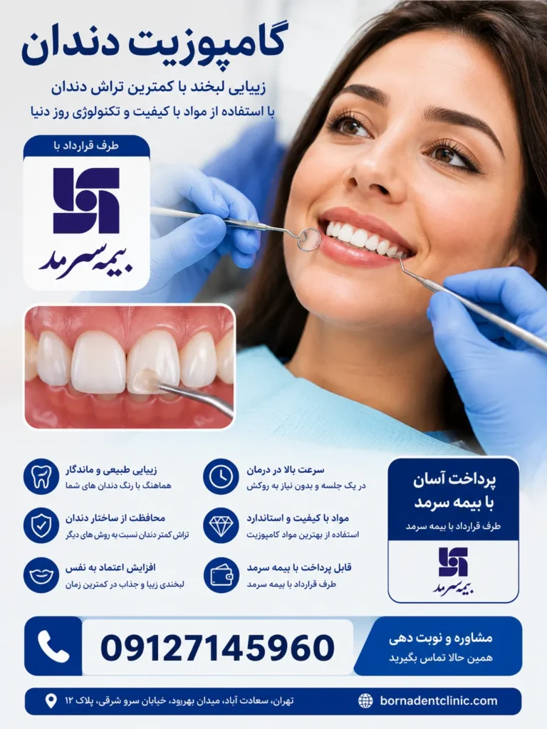 کامپوزیت دندان با بیمه سرمد