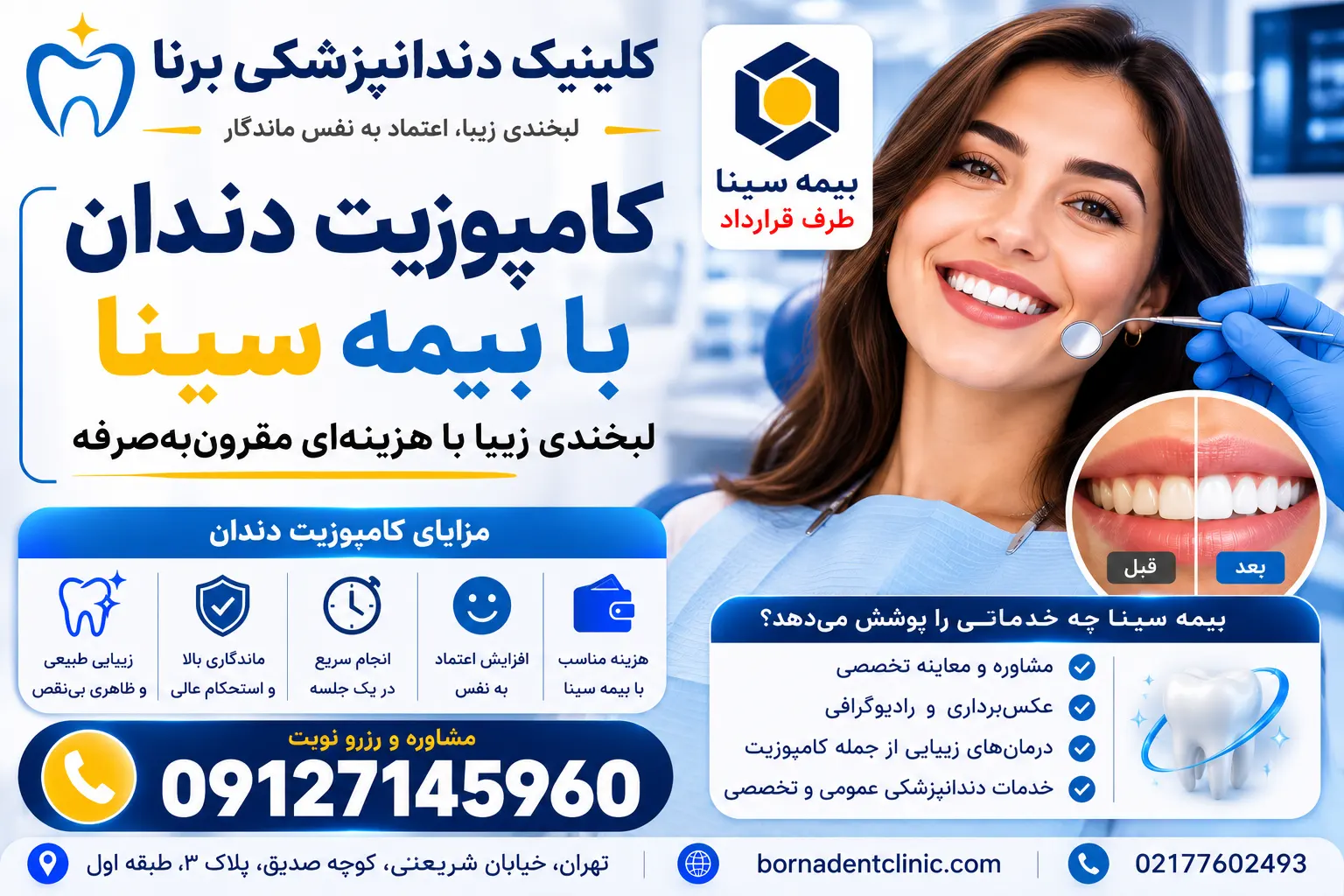 کامپوزیت دندان با بیمه سینا
