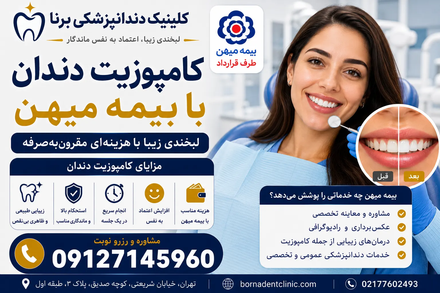 کامپوزیت دندان با بیمه میهن