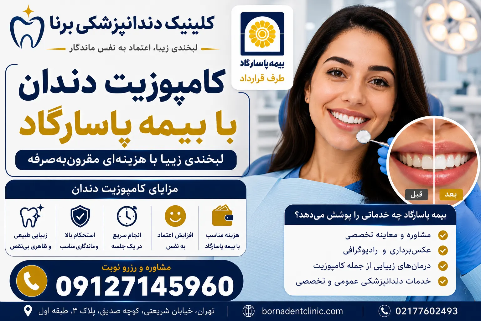 کامپوزیت دندان با بیمه پاسارگاد