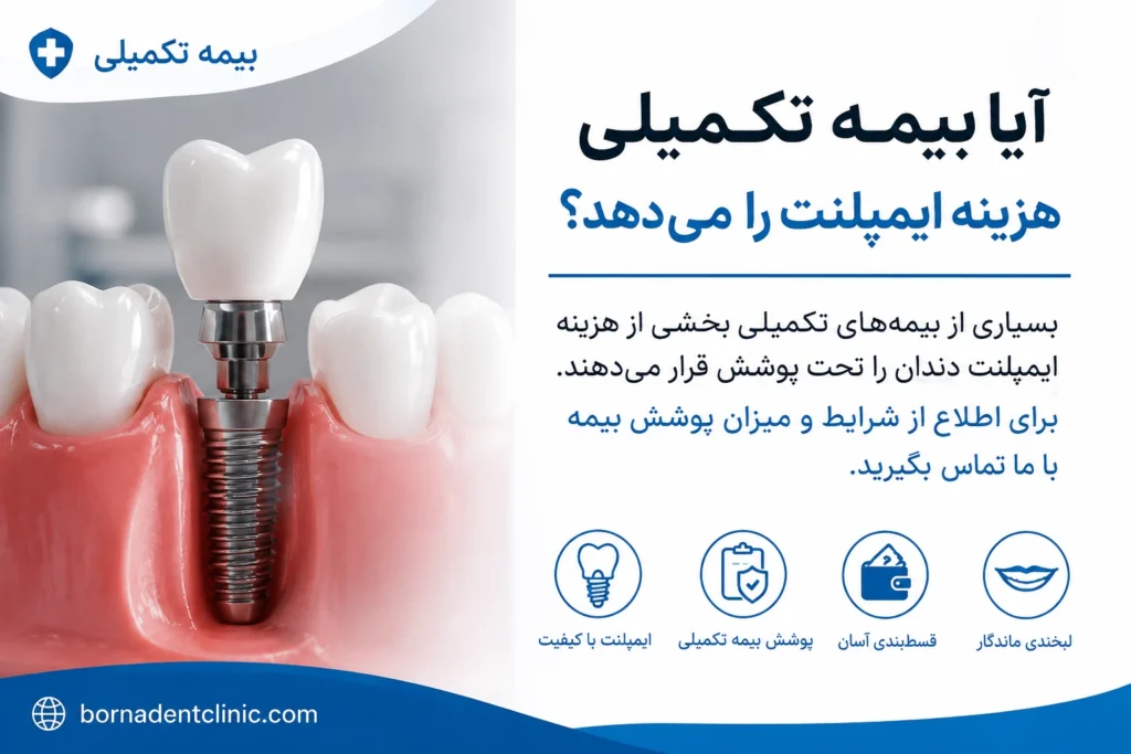 آیا بیمه تکمیلی هزینه ایمپلنت را می دهد