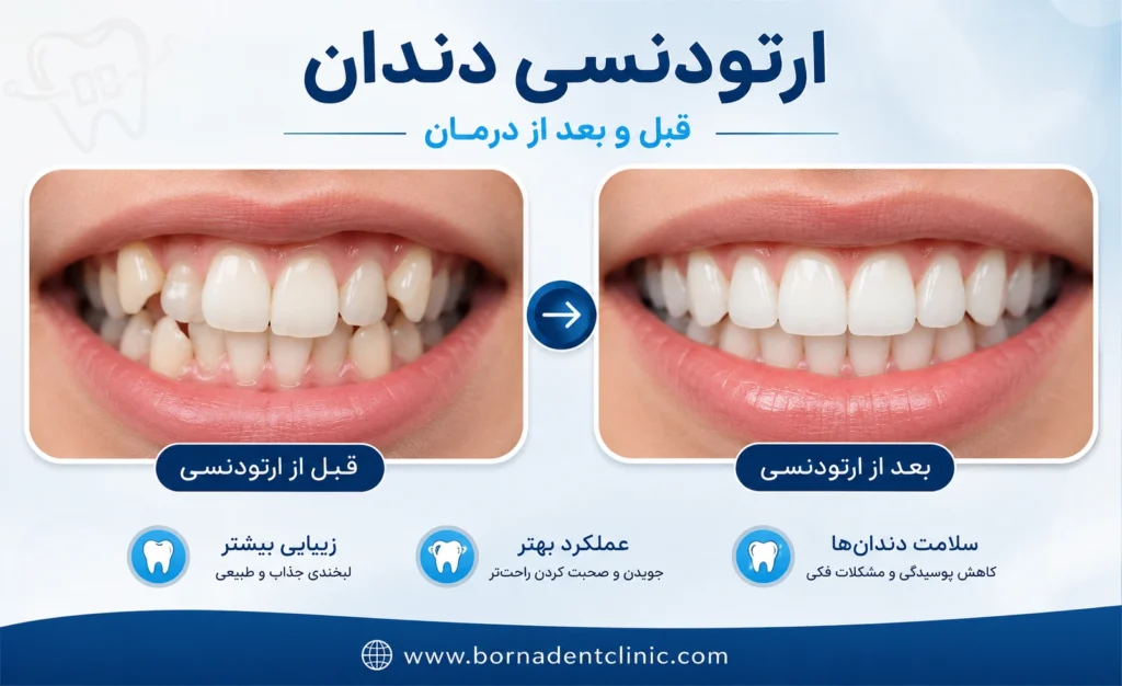 ارتودنسی دندان با بیمه ایران
