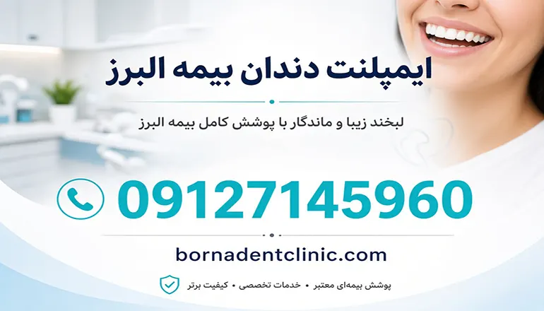ایمپلنت دندان بیمه البرز