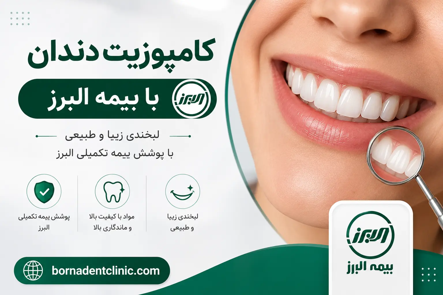 کامپوزیت دندان با بیمه البرز