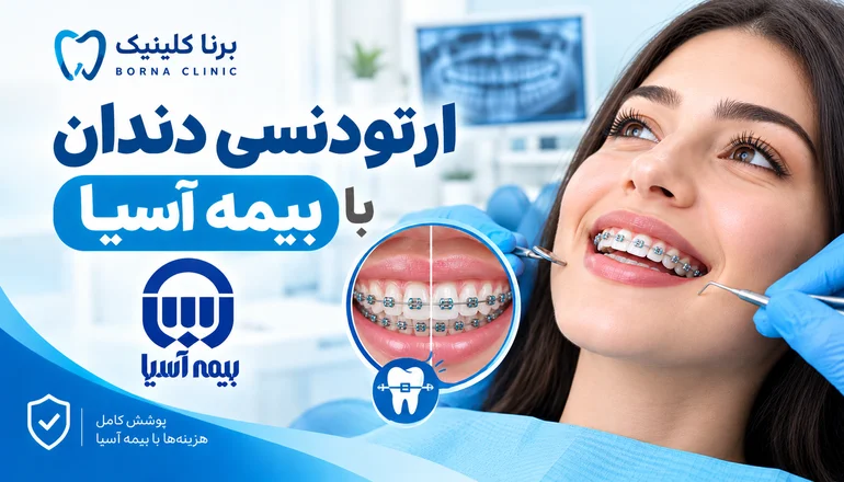 ارتودنسی دندان با بیمه آسیا 4 ارتودنسی دندان با بیمه آسیا