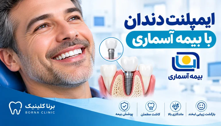 ایمپلنت دندان با بیمه آسماری