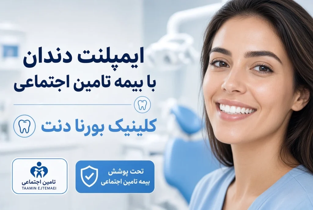 ایمپلنت دندان با بیمه تامین اجتماعی