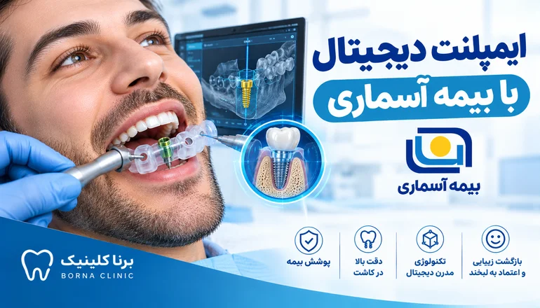 ایمپلنت دیجیتال با بیمه آسماری