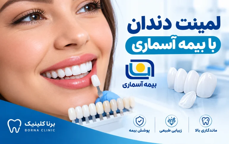 لمینت دندان با بیمه آسماری