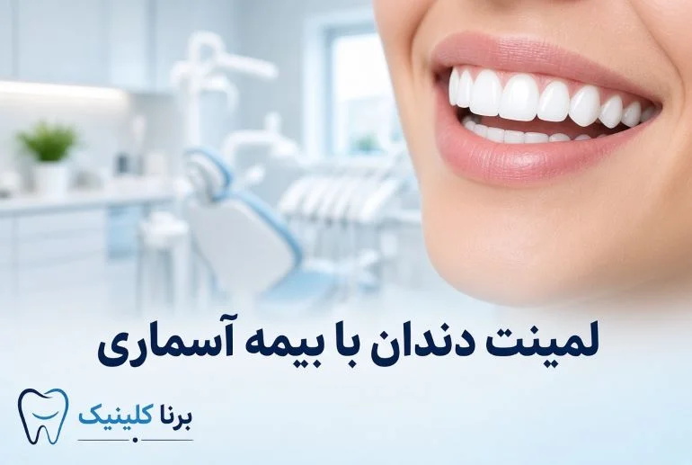 لمینت دندان با بیمه آسماری