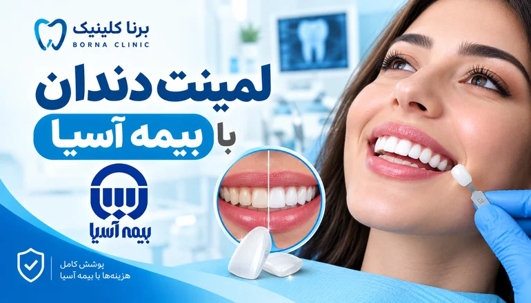 لمینت دندان با بیمه آسیا