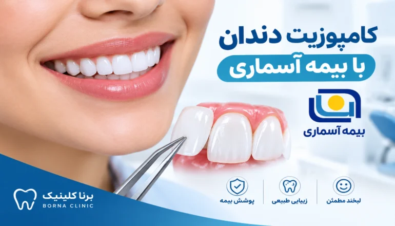 کامپوزیت دندان با بیمه آسماری