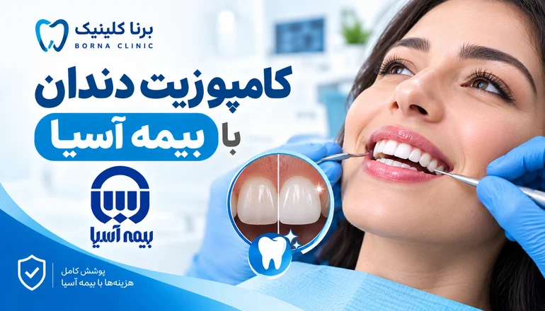 کامپوزیت دندان با بیمه آسیا