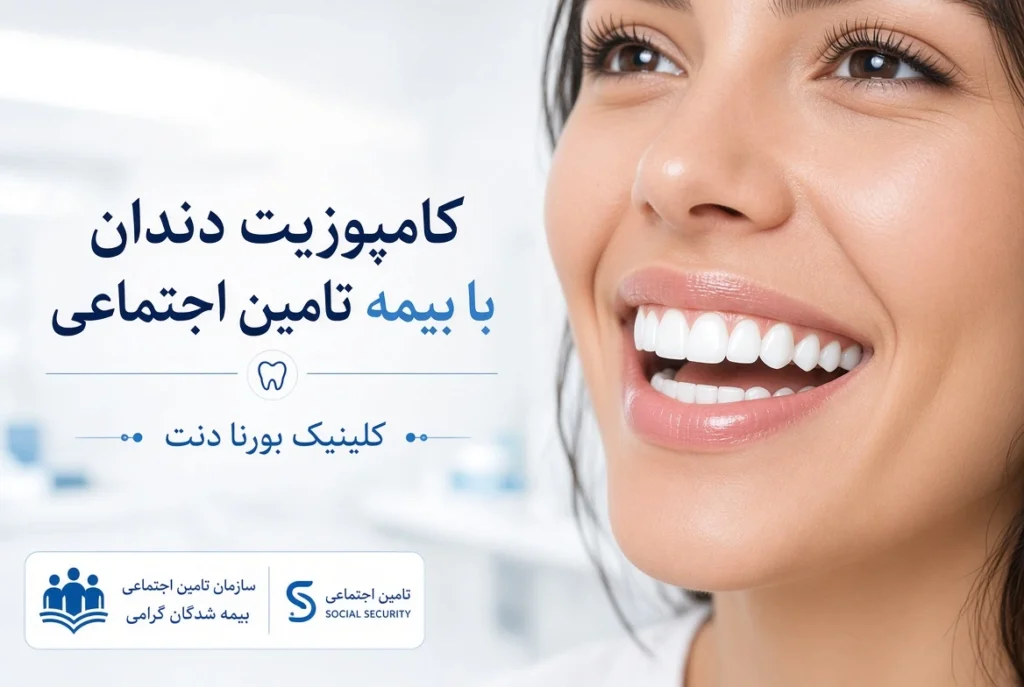 کامپوزیت دندان با بیمه تامین اجتماعی